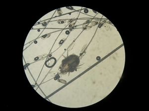 Cheyletiella parasitivorax Vergrößerung unter dem Mikroskop