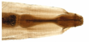 Oxyuris equi mit typischen sanduhrförmigen Ösophagus.